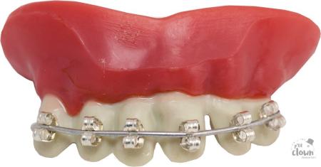 Dentier appareil dentaire